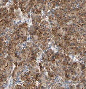 ARHGAP1 Rabbit Polyclonal Antibody