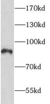 ARHGAP10 Rabbit Polyclonal Antibody