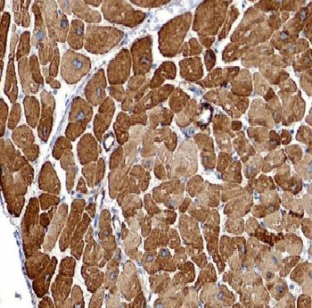 ARHGAP10 Rabbit Polyclonal Antibody