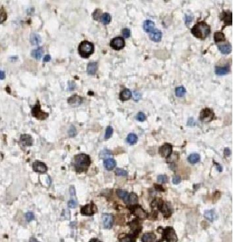 ARHGAP15 Rabbit Polyclonal Antibody