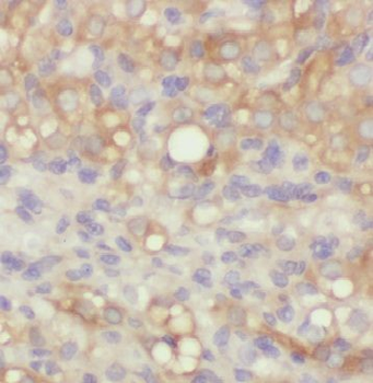 ARHGAP21 Rabbit Polyclonal Antibody
