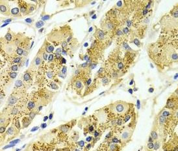 ARHGAP25 Rabbit Polyclonal Antibody