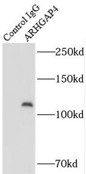 ARHGAP4 Rabbit Polyclonal Antibody