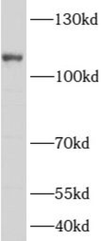 ARHGAP4 Rabbit Polyclonal Antibody