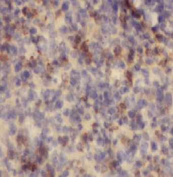 ARHGAP4 Rabbit Polyclonal Antibody