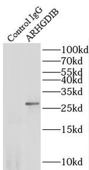 ARHGDIB Antibody