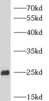 ARHGDIG Rabbit Polyclonal Antibody