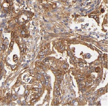 ARHGDIG Rabbit Polyclonal Antibody