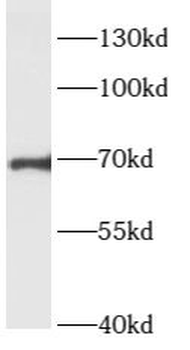 ARHGEF7 Rabbit Polyclonal Antibody