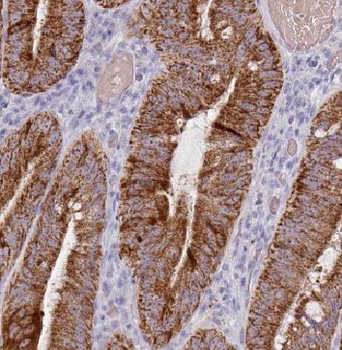 NUAK1 Rabbit Polyclonal Antibody