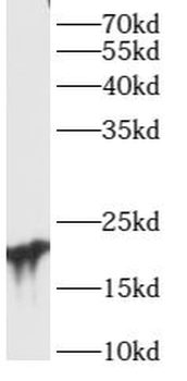 ARL15 Rabbit Polyclonal Antibody