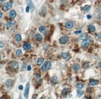 ARL15 Rabbit Polyclonal Antibody
