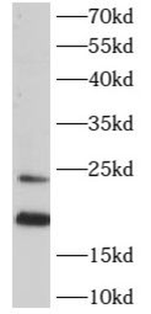 ARL2 Rabbit Polyclonal Antibody