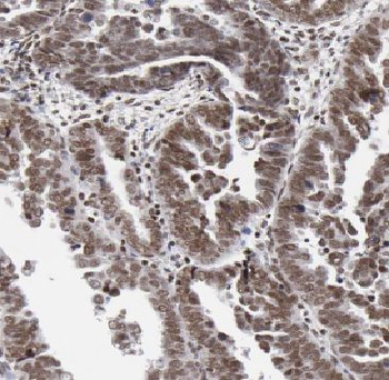 ARL2 Rabbit Polyclonal Antibody
