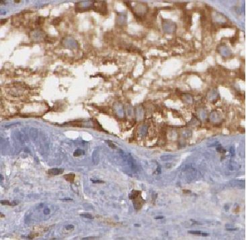 ARL3 Rabbit Polyclonal Antibody