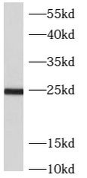 ARL5B Antibody