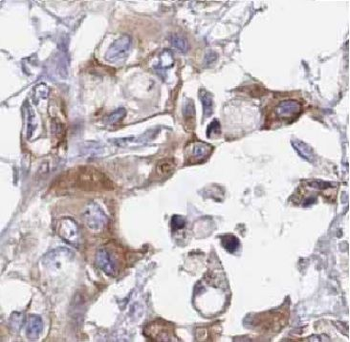 ARL5B Rabbit Polyclonal Antibody
