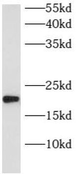 ARL8B Antibody