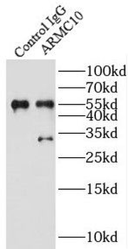 ARMC10 Rabbit Polyclonal Antibody