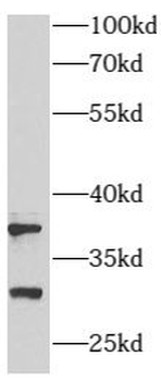 ARMC10 Rabbit Polyclonal Antibody