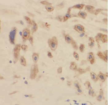 ARMC10 Rabbit Polyclonal Antibody