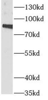 ARNT Rabbit Polyclonal Antibody