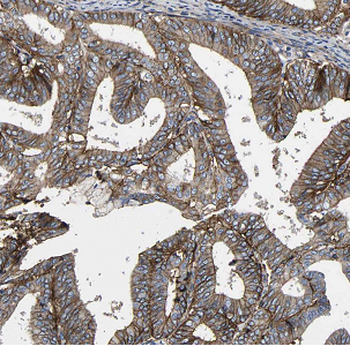 ERAP1 Rabbit Polyclonal Antibody
