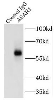 ASAH1 Antibody