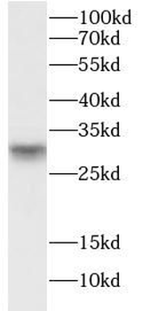 ASB13 Rabbit Polyclonal Antibody