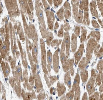 ASB13 Rabbit Polyclonal Antibody