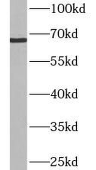 ASB14 Antibody