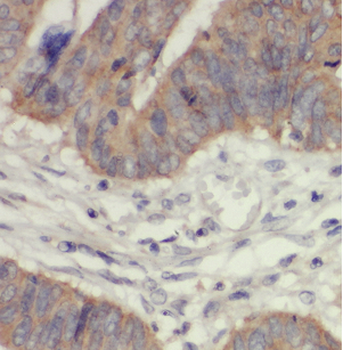 ASB8 Rabbit Polyclonal Antibody