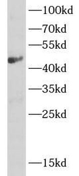 ASL Rabbit Polyclonal Antibody