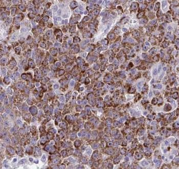 ASL Rabbit Polyclonal Antibody