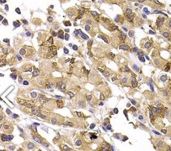 ASMTL Rabbit Polyclonal Antibody