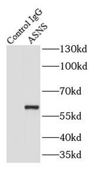 ASNS Antibody