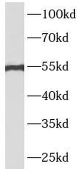 ATF4 Rabbit Polyclonal Antibody
