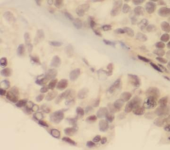 ATF4 Rabbit Polyclonal Antibody