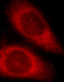 ATF6 Antibody