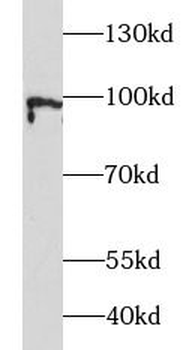 ATF6 Rabbit Polyclonal Antibody