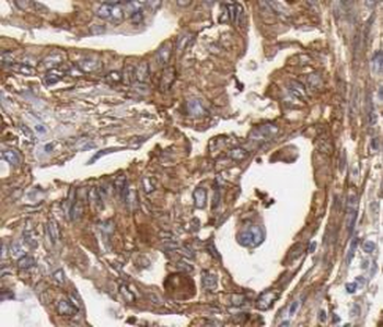 ATG2B Rabbit Polyclonal Antibody