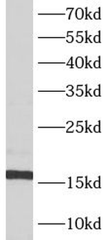 ATP5F1D Antibody