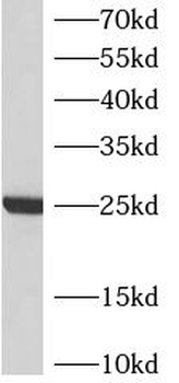 ATP5PB Rabbit Polyclonal Antibody