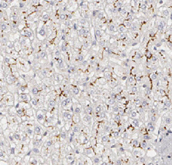 ATP5PB Rabbit Polyclonal Antibody