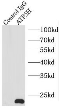 ATP5PD Rabbit Polyclonal Antibody