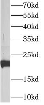 ATP5PD Rabbit Polyclonal Antibody