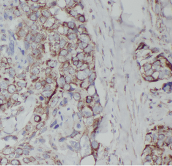 ATP5PD Rabbit Polyclonal Antibody