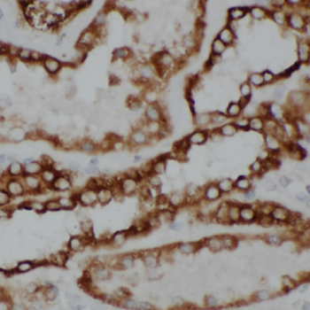 ATP6V0D1 Rabbit Polyclonal Antibody
