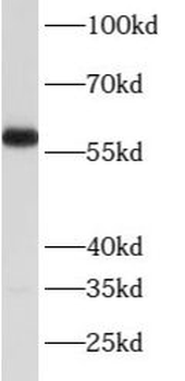 ATP6V1B2 Rabbit Polyclonal Antibody