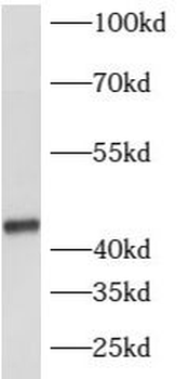ATP6V1C2 Rabbit Polyclonal Antibody
